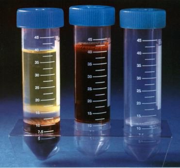 Lymphoprep-tube.jpg