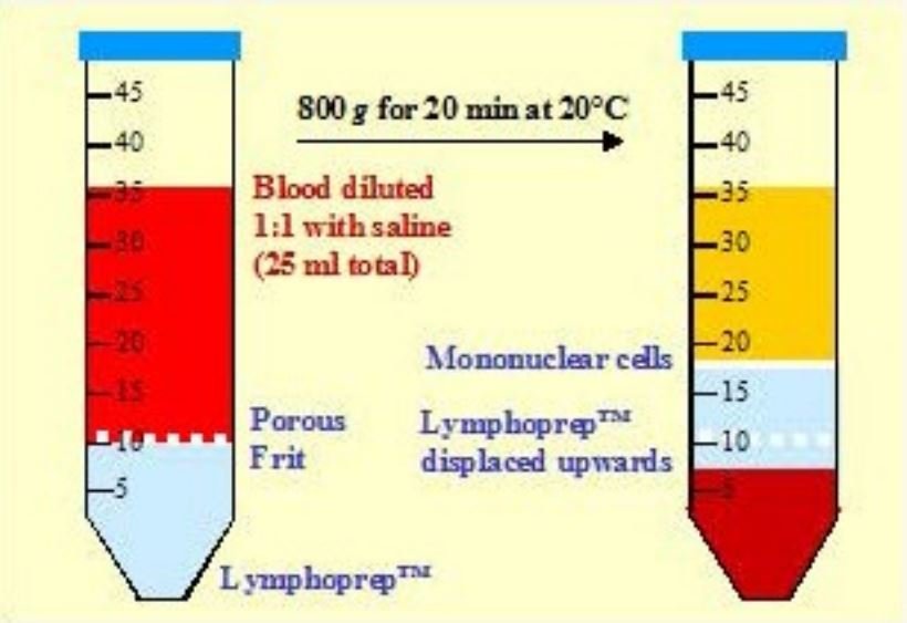 Lymphoprep-tube2.jpg