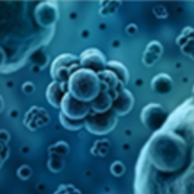 Custom protein expression services 5 expression systems ProteoGenix