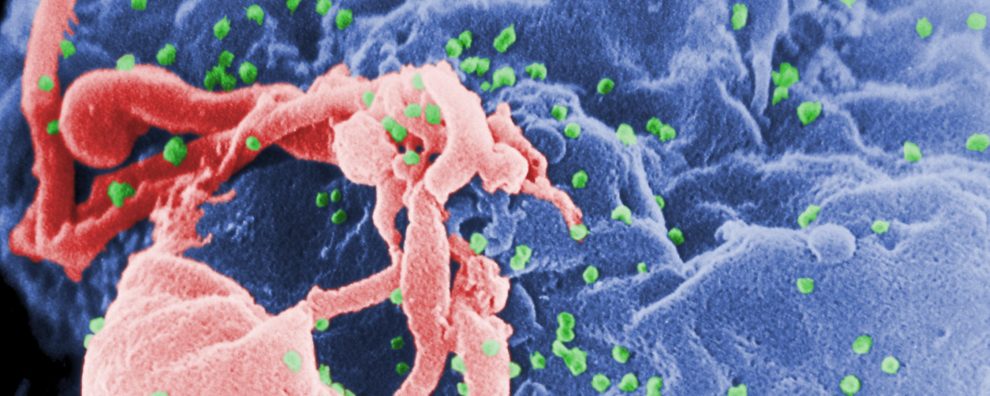 How is antibody therapy changing the way we treat HIV?