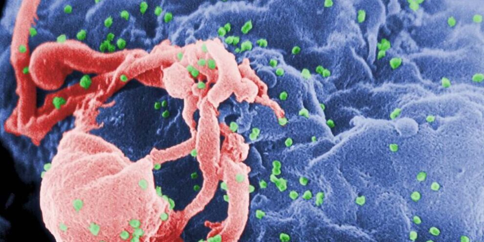 How is antibody therapy changing the way we treat HIV?