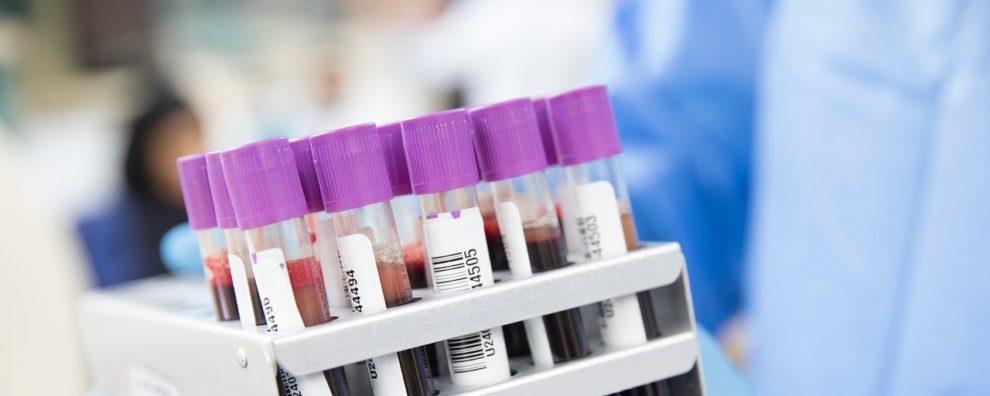 Can mRNA therapeutics overcome the limitations of typical monoclonal antibody production processes?