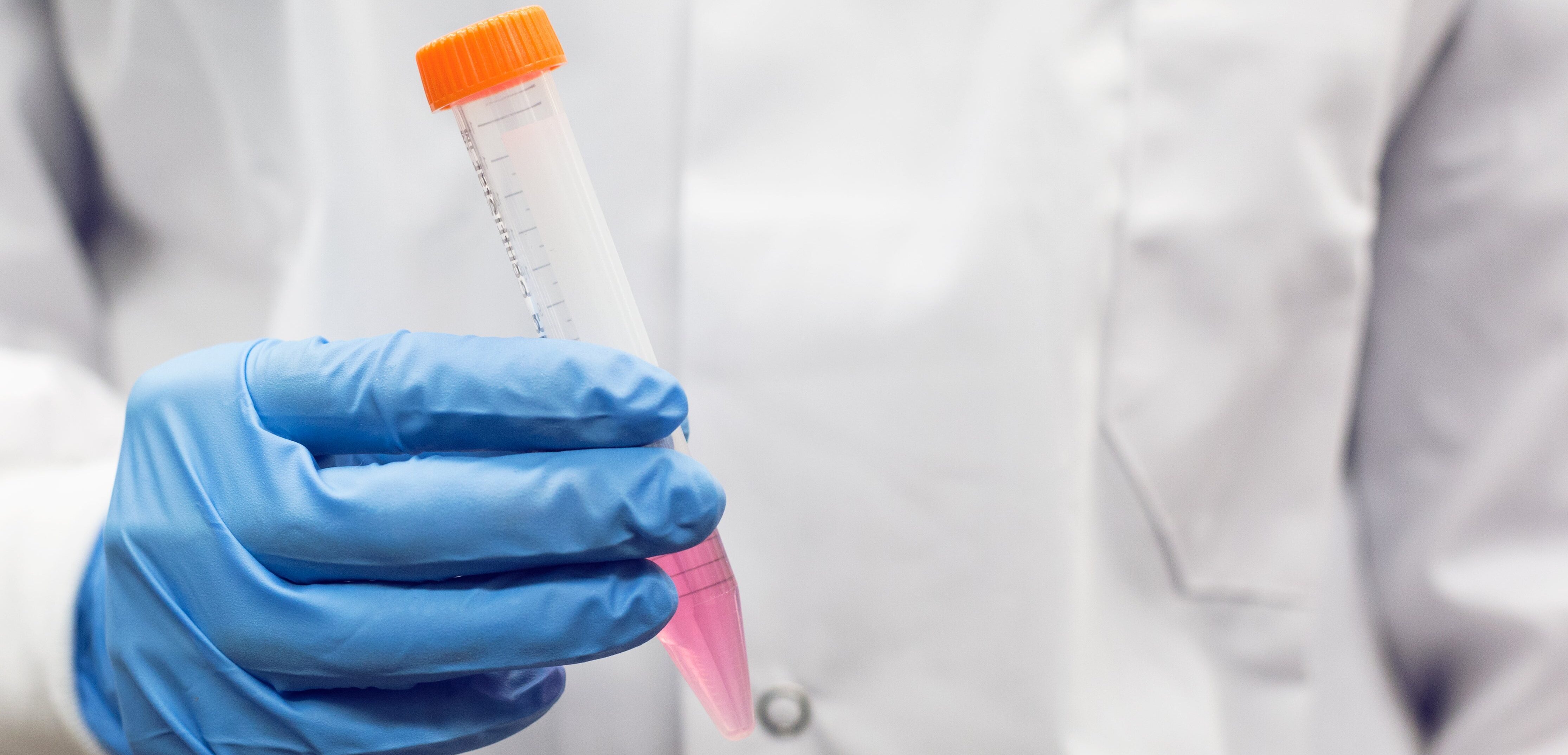 Strengthen Antibody Patents with our Epitope and Paratope Mapping service