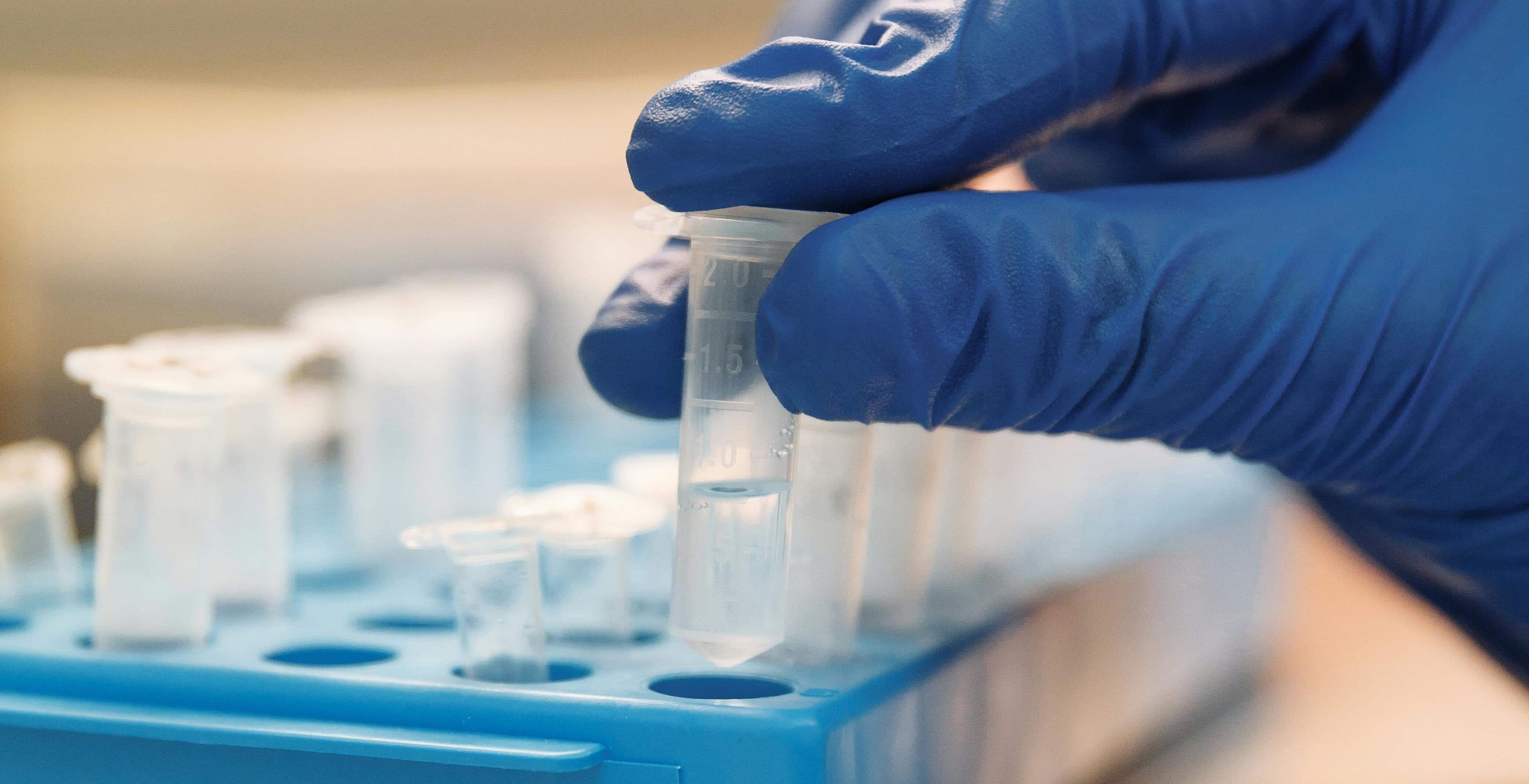 Reduce Regulatory Uncertainty with Expert-Guided Antibody Characterization services