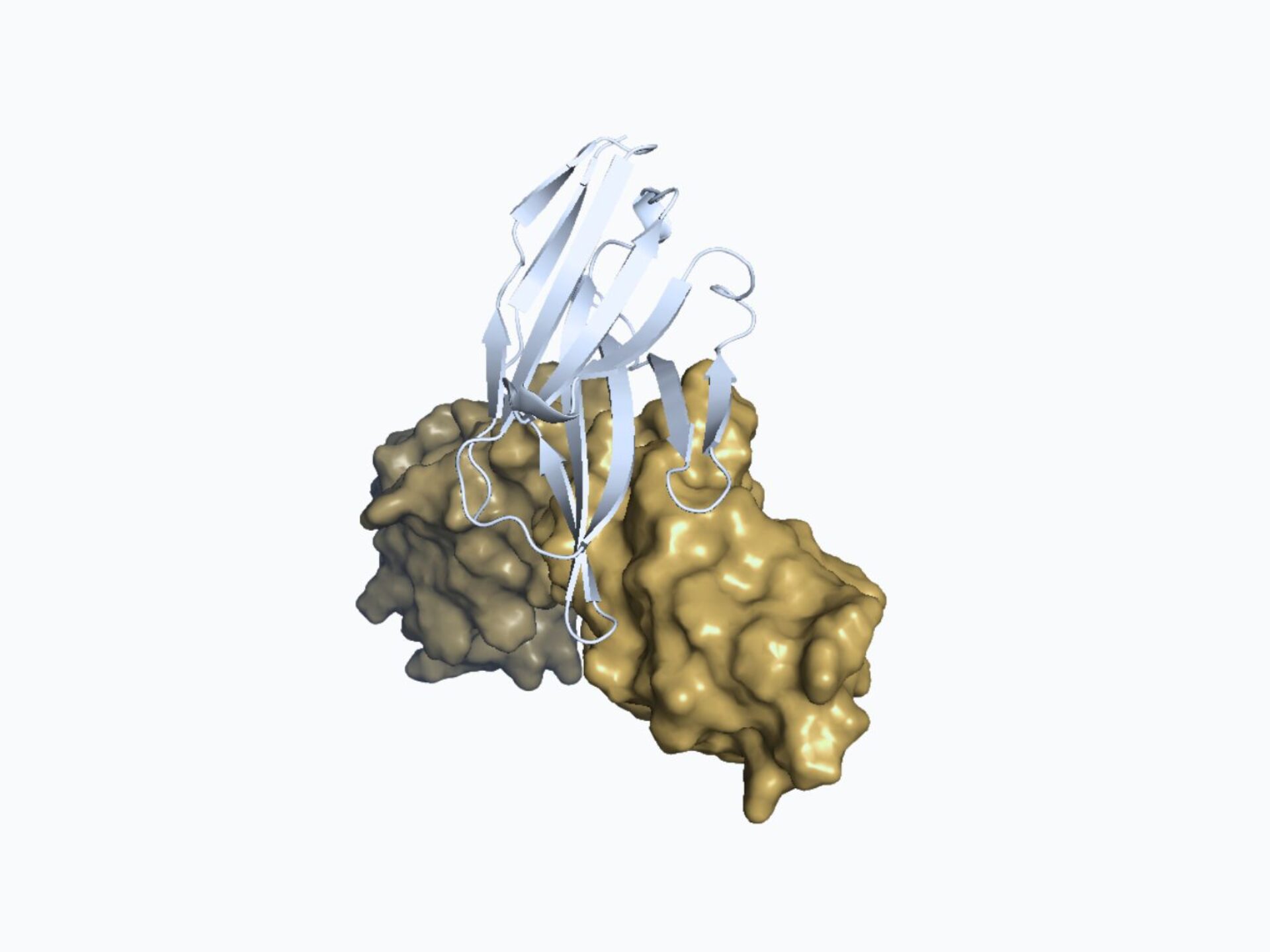 case report 3D modelisation figure 2